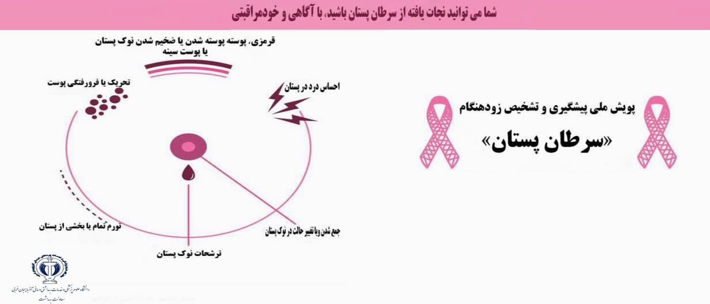  اجراي پويش ملي پيشگيري و تشخيص زودهنگام سرطان پستان